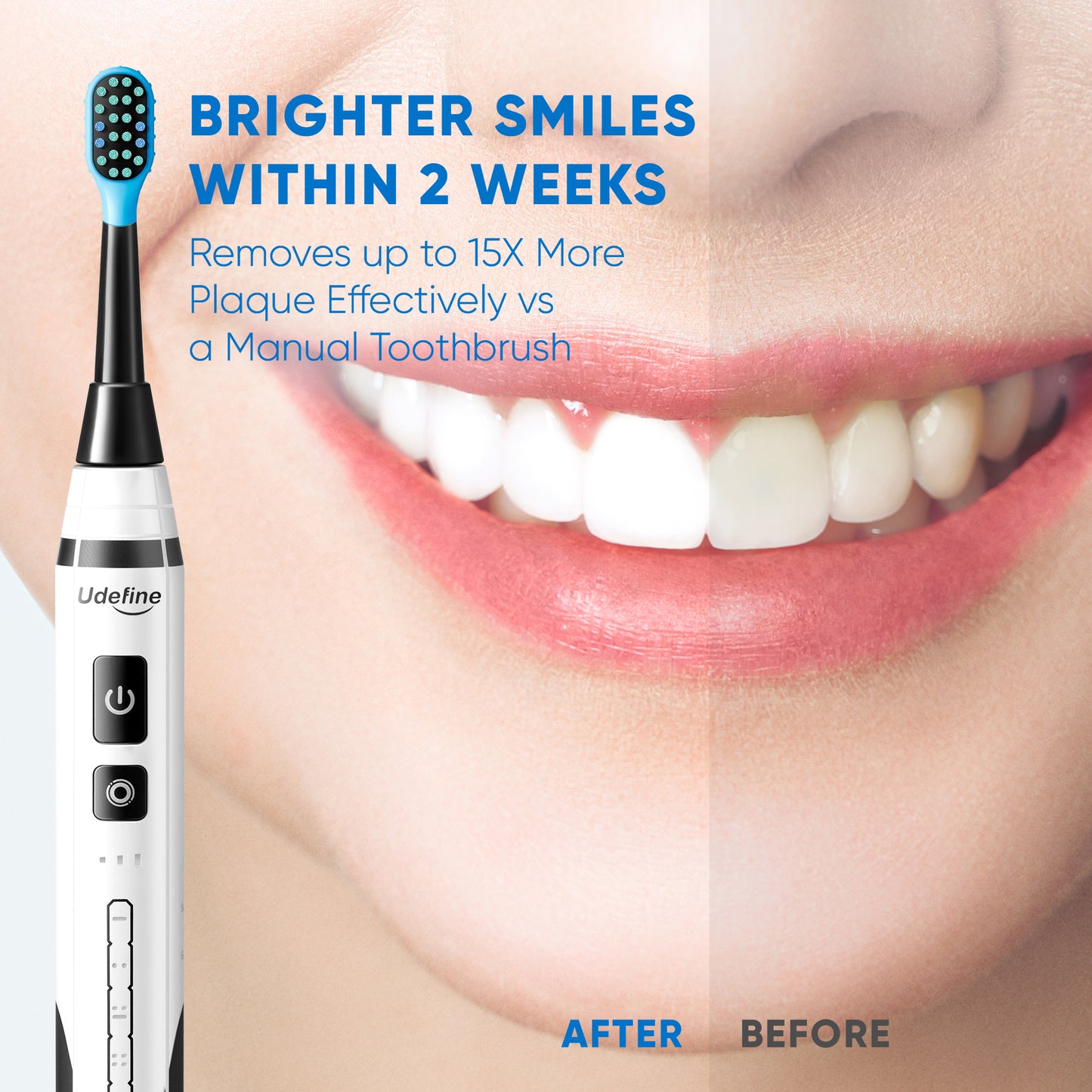 Udefine Oral Master - Sonic Electric Toothbrush