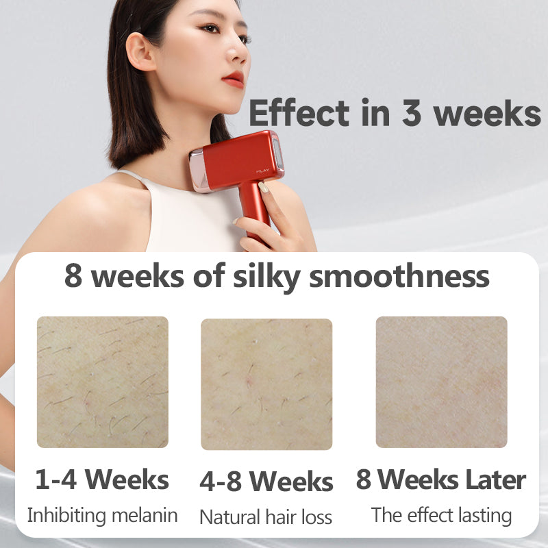 MLAY Hair Removal Device-T14