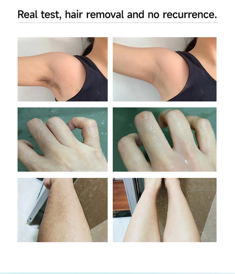MLAY Hair Removal Device-T15