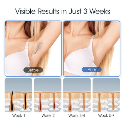 MLAY Hair Removal Device-T14